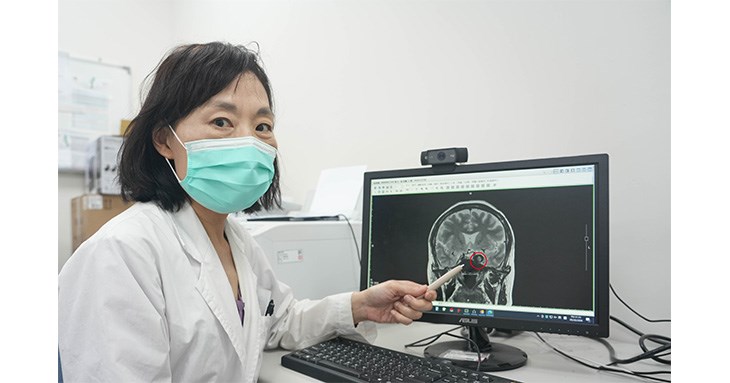 神經內科柯麗櫻醫師指出,陳小姐經過核磁共振檢查發現異狀後,立即安排血管攝影,發現腦內竟藏著兩顆大型動脈瘤,最大的直徑達1.6公分,造成動眼神經壓迫。(圖片提供/光田綜合醫院)
