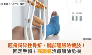 脛骨粉碎性骨折，腿部腫脹險截肢！固定手術＋高壓氧治療解除危機
