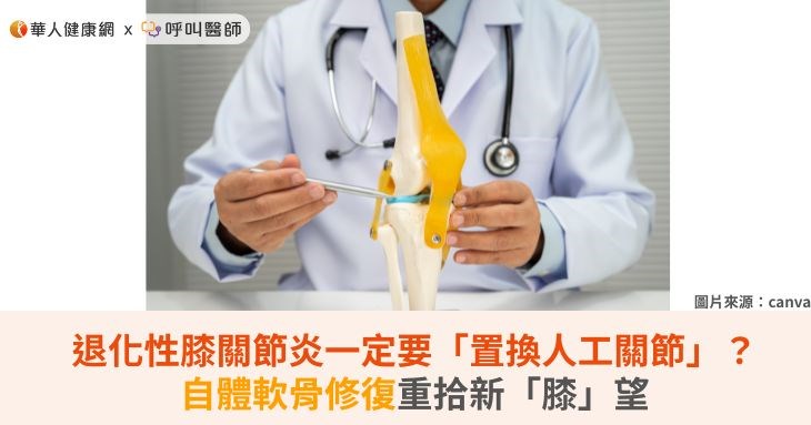 退化性膝關節炎一定要「置換人工關節」?自體軟骨修復重拾新「膝」望