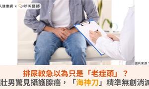 排尿較急以為只是「老症頭」？壯男驚見攝護腺癌，「海神刀」精準無創消滅