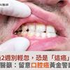 嘴破超過2週別輕忽，恐是「這癌」找上門！醫籲：留意口腔癌黃金警訊