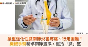 嚴重退化性膝關節炎害疼痛、行走困難！機械手臂精準關節置換，重拾「膝」望
