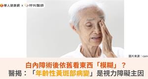 白內障術後依舊看東西「模糊」？醫揭：「年齡性黃斑部病變」是視力障礙主因