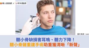 聽小骨缺損害耳鳴、聽力下降！聽小骨鏈重建手術助重獲清晰「新聲」