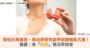 腎結石再復發，揪出原發性副甲狀腺機能亢進！醫籲：有「這些」情况早檢查