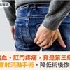 排便出血、肛門疼痛，竟是第三級痔瘡！雙極雷射消融手術，降低術後恢復負擔