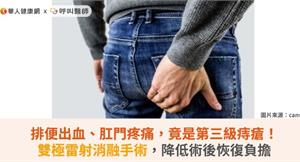 排便出血、肛門疼痛，竟是第三級痔瘡！雙極雷射消融手術，降低術後恢復負擔
