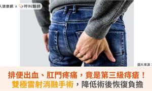 排便出血、肛門疼痛，竟是第三級痔瘡！雙極雷射消融手術，降低術後恢復負擔