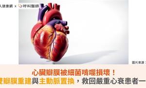 心臟瓣膜被細菌啃噬損壞!雙瓣膜重建與主動脈置換,搶救嚴重心衰患者一命