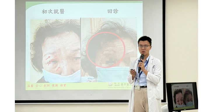 吳宇軒醫師表示,皰疹病毒入侵臉部,病毒可能沿著神經進入大腦引發腦炎,或直接傷及角膜、視網膜造成視力受損,嚴重時甚至會導致永久性失明。(圖片提供/衛生福利部臺中醫院)