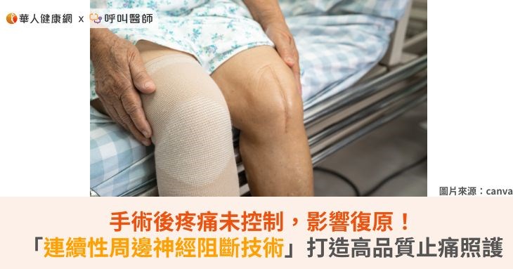 手術後疼痛未控制,影響復原!「連續性周邊神經阻斷技術」打造高品質止痛照護