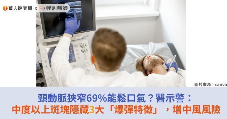 頸動脈狹窄69%能鬆口氣?醫示警:中度以上斑塊隱藏3大「爆彈特徵」,增中風風險