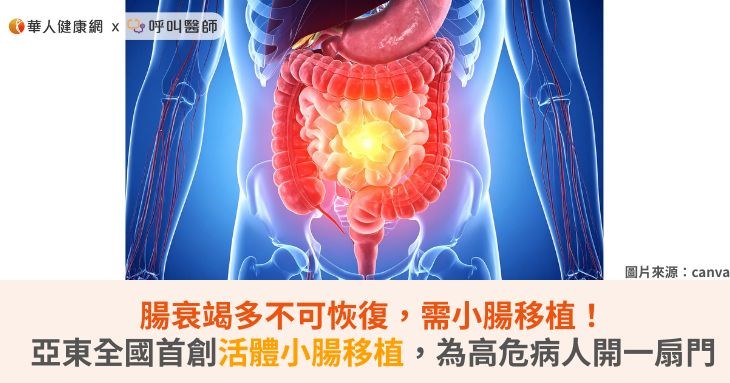 腸衰竭多不可恢復,需小腸移植!亞東全國首創活體小腸移植,為高危病人開一扇門