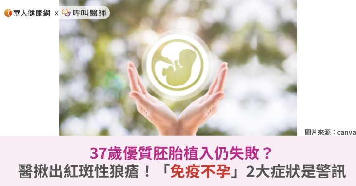 37歲優質胚胎植入仍失敗?醫揪出紅斑性狼瘡!「免疫不孕」2大症狀是警訊