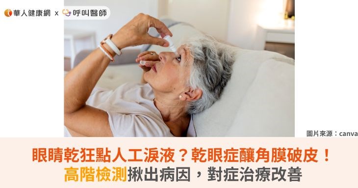 眼睛乾狂點人工淚液?乾眼症釀角膜破皮!高階檢測揪出病因,對症治療改善