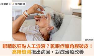 眼睛乾狂點人工淚液?乾眼症釀角膜破皮!高階檢測揪出病因,對症治療改善
