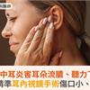 慢性中耳炎害耳朵流膿、聽力下降！微創精準耳內視鏡手術傷口小、恢復快