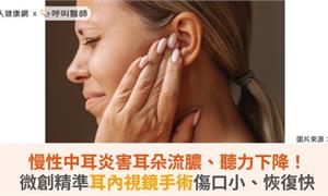 慢性中耳炎害耳朵流膿、聽力下降!微創精準耳內視鏡手術傷口小、恢復快