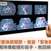 原本要置換膝關節，竟變「緊急開腦」！跨科團隊攔截隱形殺手，救回婦人一命