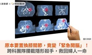 原本要置換膝關節,竟變「緊急開腦」!跨科團隊攔截隱形殺手,救回婦人一命
