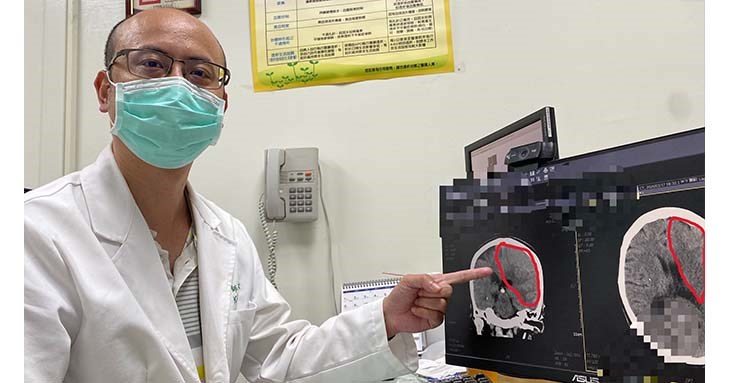 神經外科賈開傑醫師解釋患者腦部出血面積(圖中紅圈處)。(圖片提供/員榮醫院)