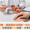 排尿變順暢，攝護腺就沒問題？切片揪出癌蹤！醫：定期追蹤PSA指數，才是保命符 