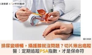 排尿變順暢,攝護腺就沒問題?切片揪出癌蹤!醫:定期追蹤PSA指數,才是保命符