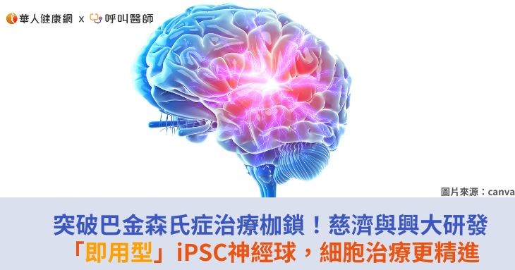 突破巴金森氏症治療枷鎖!慈濟與興大研發「即用型」iPSC神經球,細胞治療更精進