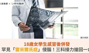 18歲女學生感冒後併發罕見「雷米爾氏症」侵腦！三科接力搶回一命