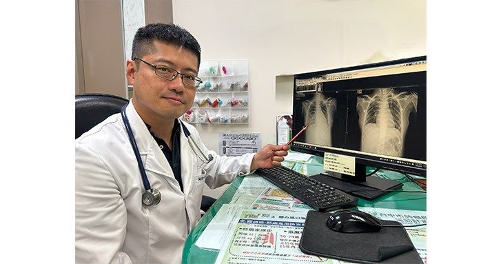 胸腔內科醫師陳君禮指出,患者入院時已出現低血壓與心跳過快等敗血症徵象,從看似單純的呼吸道感染中察覺異常,安排影像與相關檢查後,發現咽後膿瘍及敗血性肺栓塞。(圖片提供/衛生福利部豐原醫院)