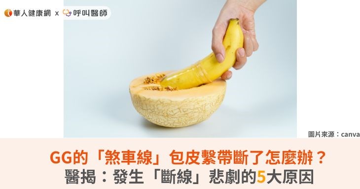 GG的「煞車線」包皮繫帶斷了怎麼辦?醫揭:發生「斷線」悲劇的5大原因
