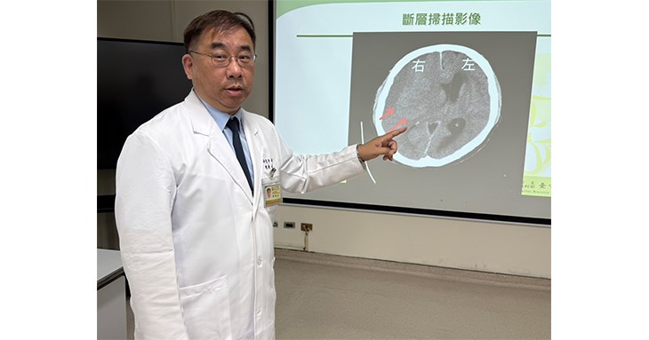 衛生福利部臺中醫院神經外科陳典廷主任說明,患者上個月因左側手腳無力持續兩天未改善就醫,檢查發現右側「亞急性腦出血」。(圖片提供/衛生福利部臺中醫院)