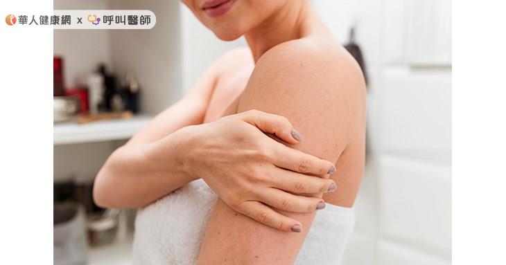 光過敏患者在曬太陽後,通常會過幾天才出現類似濕疹或血管水腫症狀;嚴重個案甚至連沒有直接曬到太陽的部位,也可能出現過敏反應。