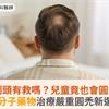 鬼剃頭有救嗎？兒童竟也會圓禿！小分子藥物治療嚴重圓禿新選擇