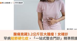 腹痛竟藏3.2公斤巨大腫瘤！女確診罕病結節硬化症，「一站式整合門診」精準照護