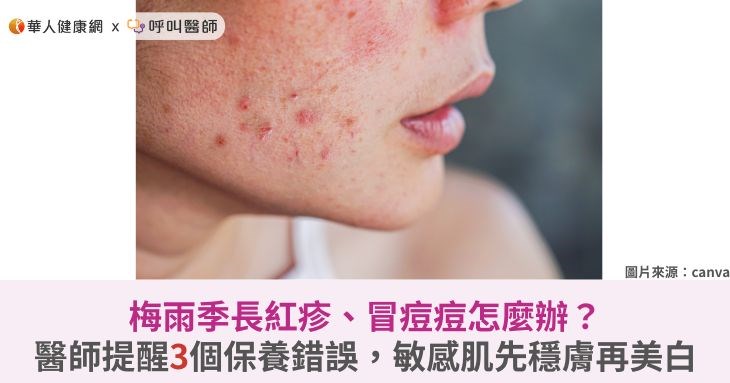 梅雨季長紅疹、冒痘痘怎麼辦?醫師提醒3個保養錯誤,敏感肌先穩膚再美白