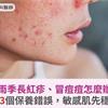 梅雨季長紅疹、冒痘痘怎麼辦？醫師提醒3個保養錯誤，敏感肌先穩膚再美白