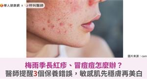梅雨季長紅疹、冒痘痘怎麼辦？醫師提醒3個保養錯誤，敏感肌先穩膚再美白