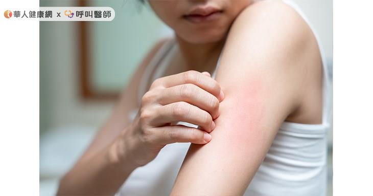 宋奉宜醫師提醒,肌膚發出紅色警戒時最需要的不是盲目「加料」,而是適度「斷捨離」。