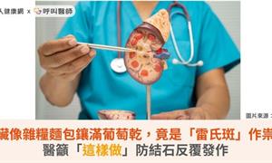 腎臟像雜糧麵包鑲滿葡萄乾，竟是「雷氏斑」作祟！醫籲「這樣做」防結石反覆發作