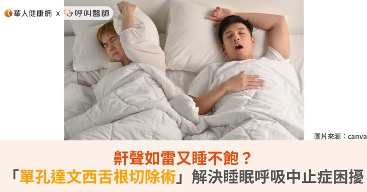 鼾聲如雷又睡不飽?「單孔達文西舌根切除術」解決睡眠呼吸中止症困擾