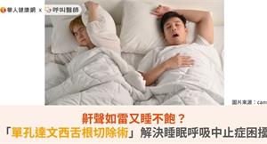 鼾聲如雷又睡不飽？「單孔達文西舌根切除術」解決睡眠呼吸中止症困擾