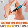 十字韌帶重建失敗還有救嗎？足球猛將靠生物材料治療，重返球場奔馳