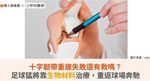 十字韌帶重建失敗還有救嗎？足球猛將靠生物材料治療，重返球場奔馳
