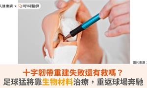 十字韌帶重建失敗還有救嗎？足球猛將靠生物材料治療，重返球場奔馳