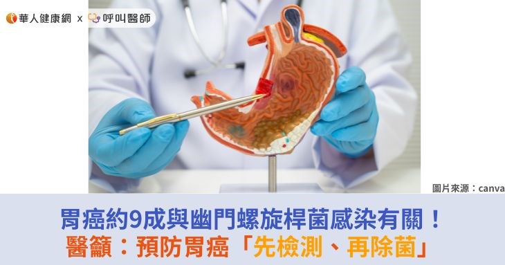 胃癌約9成與幽門螺旋桿菌感染有關!醫籲:預防胃癌「先檢測、再除菌」