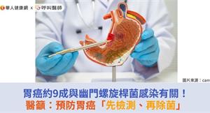胃癌約9成與幽門螺旋桿菌感染有關！醫籲：預防胃癌「先檢測、再除菌」