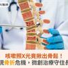 咳嗽照X光竟揪出骨鬆！AI提前發現骨折危機，微創治療守住長者行動力