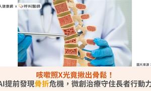 咳嗽照X光竟揪出骨鬆!AI提前發現骨折危機,微創治療守住長者行動力