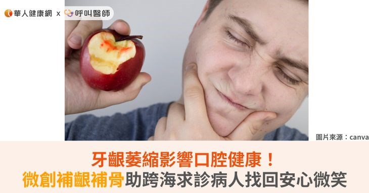 牙齦萎縮影響口腔健康!微創補齦補骨助跨海求診病人找回安心微笑